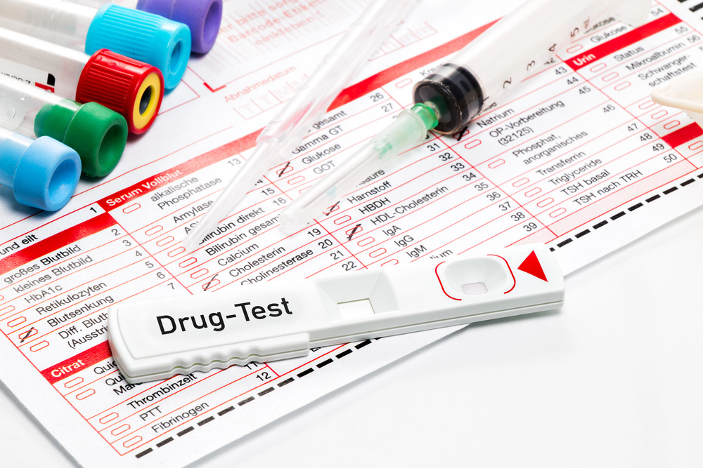 DOT Drug Testing Frequency: What Employers Must Know