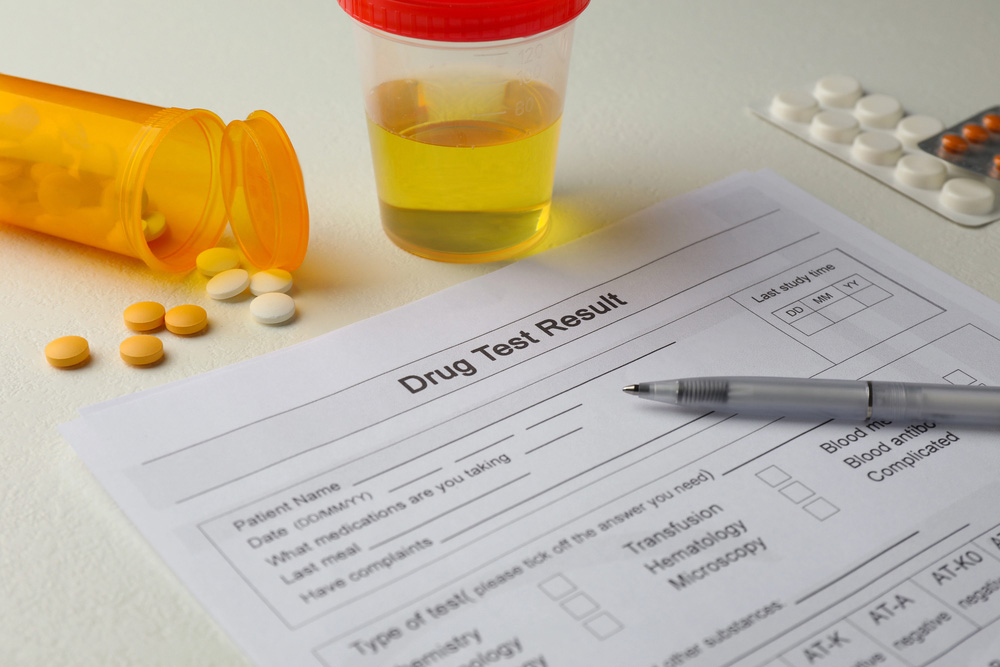Understanding DOT Drug Test Results: How Long They Take And What To Expect